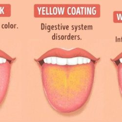 Tongue antibiotics develops